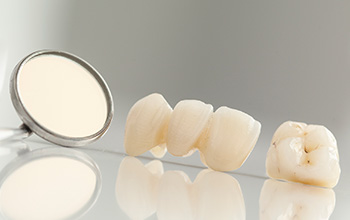 Restore your smile with a crown and dental bridge in Farmington.