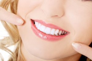 woman smiling pointing at teeth